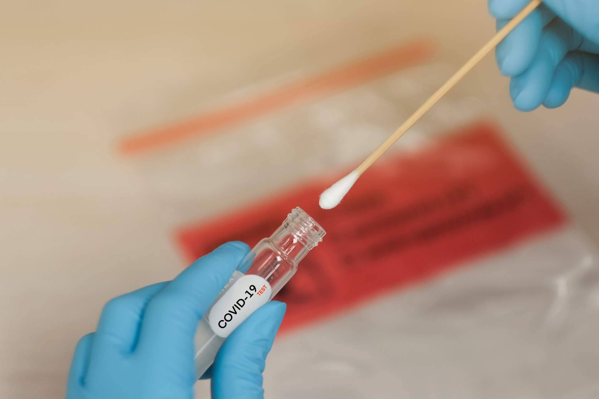 Centro Médico Bravo, test covid Madrid para estar tranquilo en las comidas y cenas con familiares