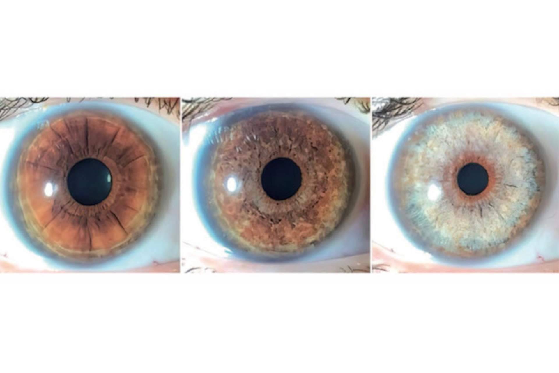 Los productos crece pestañas pueden oscurecer los ojos, por Clínica Eyecos