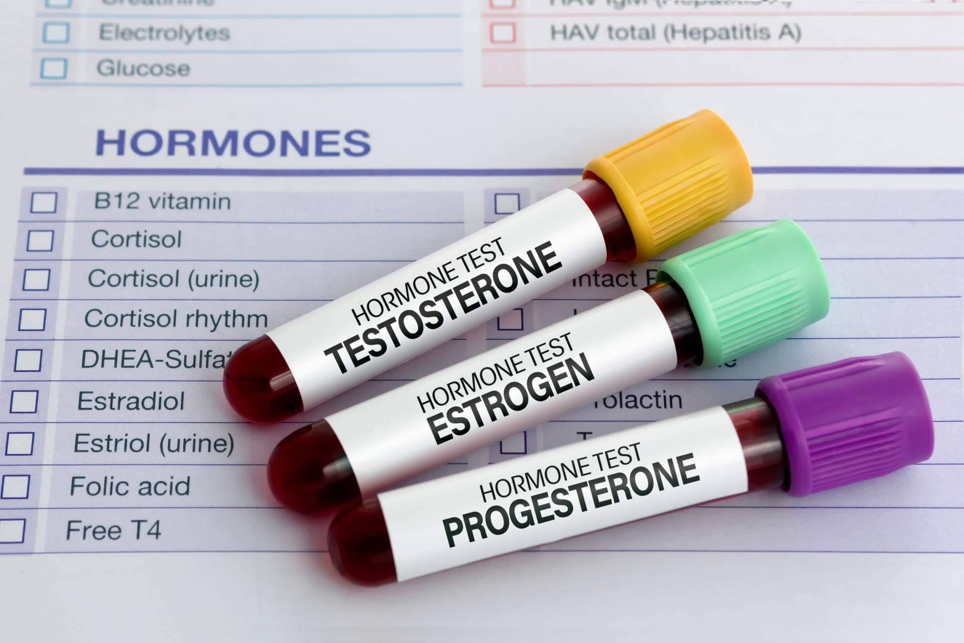 Razones por las que es necesario un análisis de testosterona