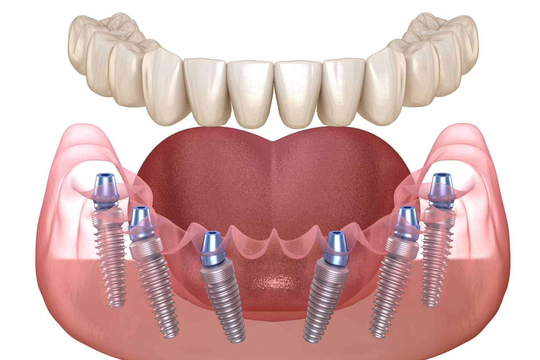 La amplia oferta de servicios odontológicos que ofrece la Clínica Dental Arai