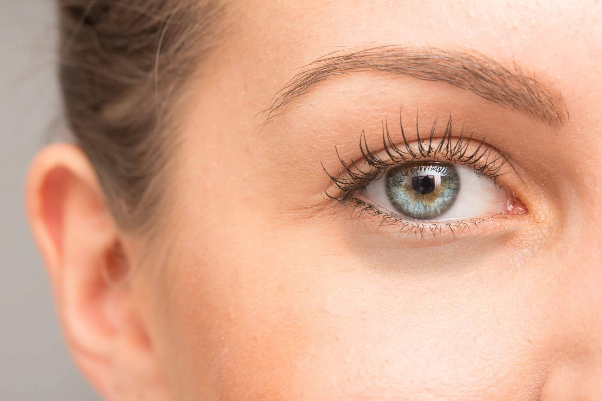 Alluring Clinic realiza el tratamiento de ojeras con ácido hialurónico