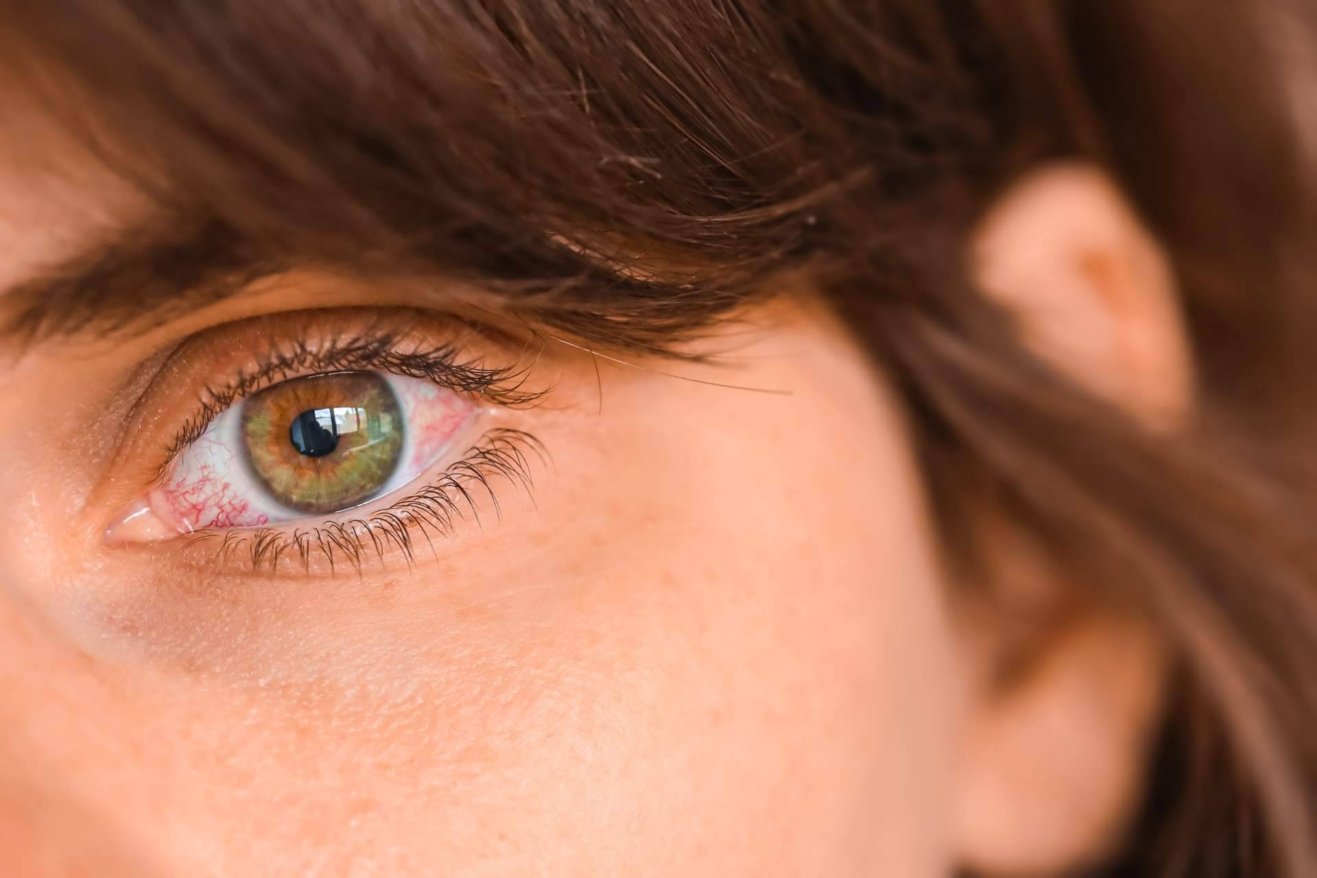 ¿Cuál es la solución perfecta para combatir el ojo seco?