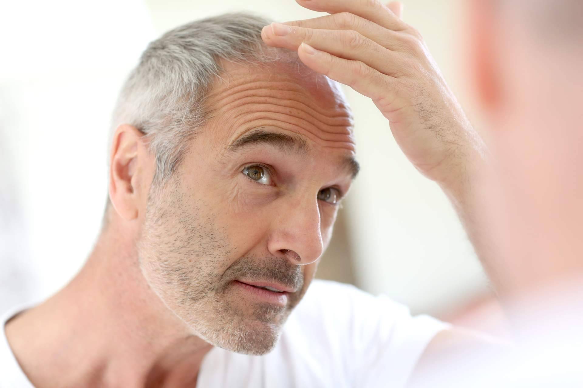Reforzar, fortalecer y reequilibrar el cabello desde la raíz con la línea de productos de Vichy Dercos disponible en FarmaSky