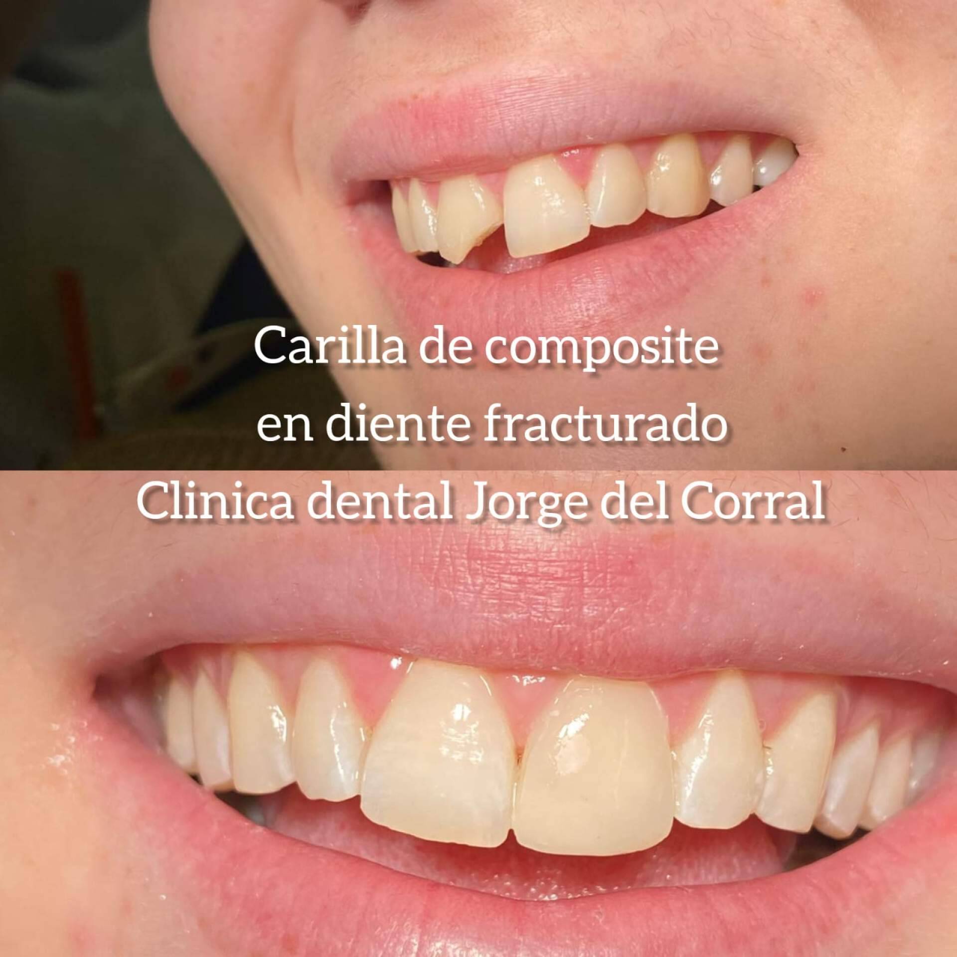 Jorge del Corral, la clínica dental de referencia en Hortaleza para estética y salud bucodental