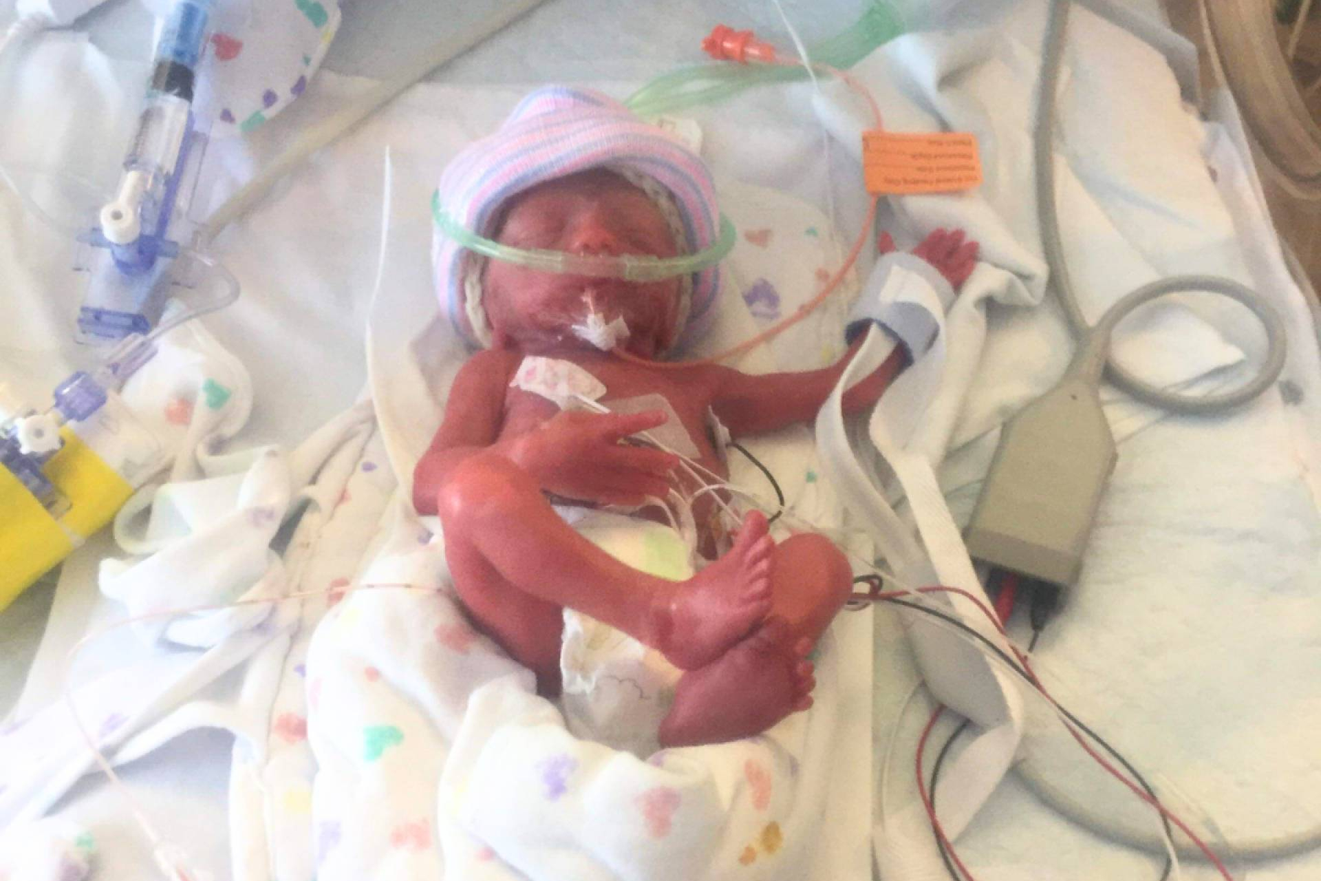 El viaje invisible de los bebés prematuros y sus familias, apoyado por Pequeños Grandes Héroes